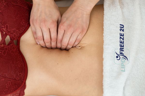 diastasis recti treatment Bury St Edmunds