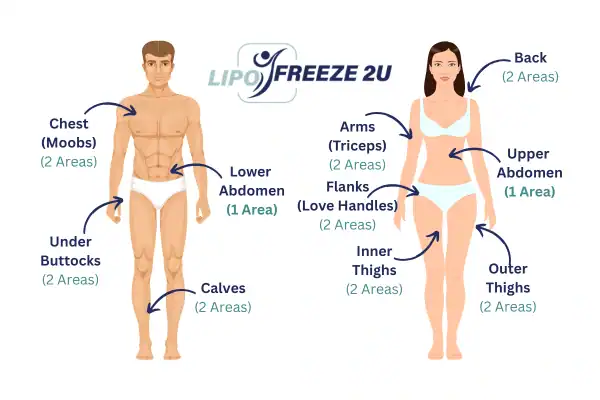 Areas you can have fat freezing treatment Bury St Edmunds