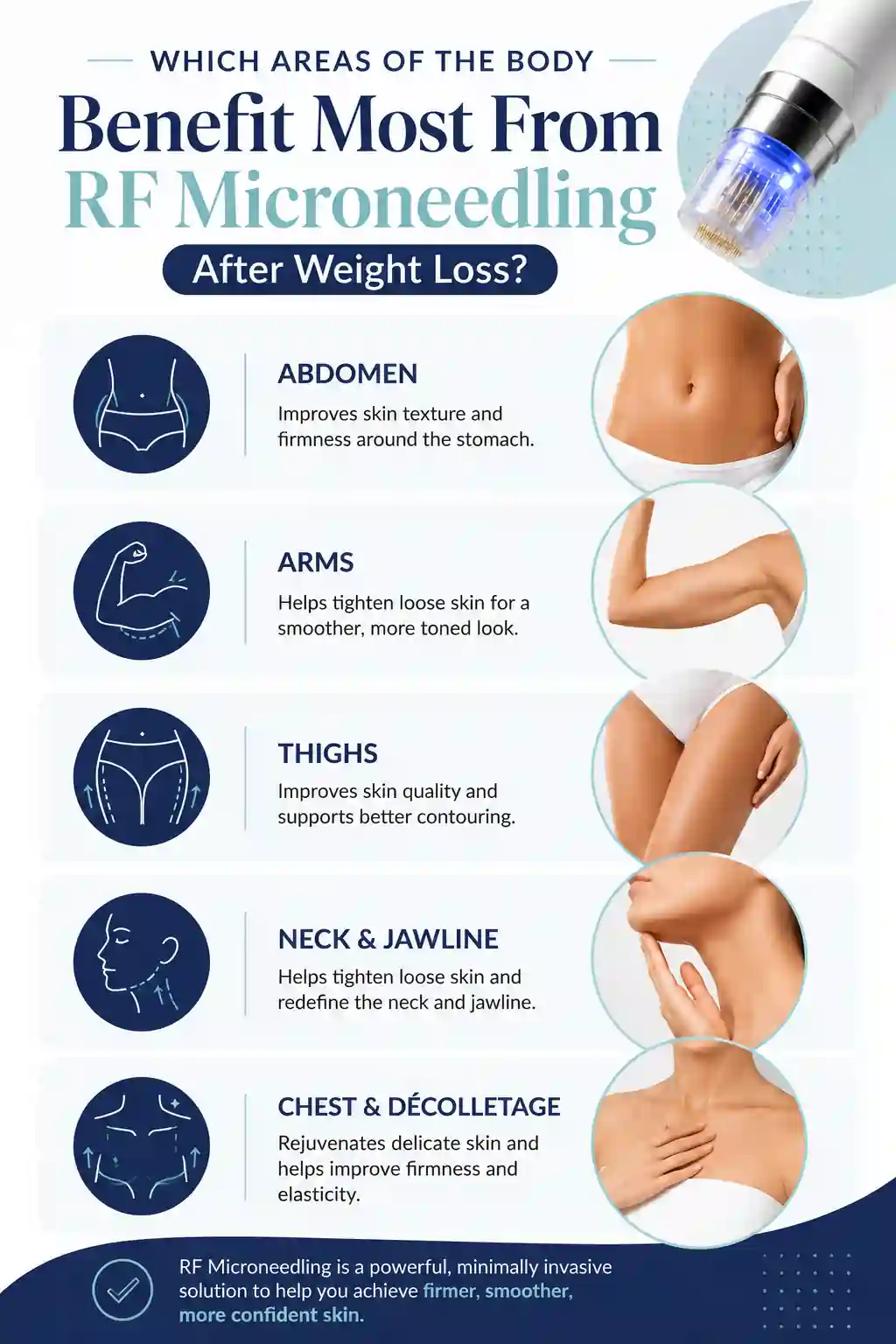 Which Areas of the Body Benefit Most From RF Microneedling After Weight Loss Bury St Edmunds